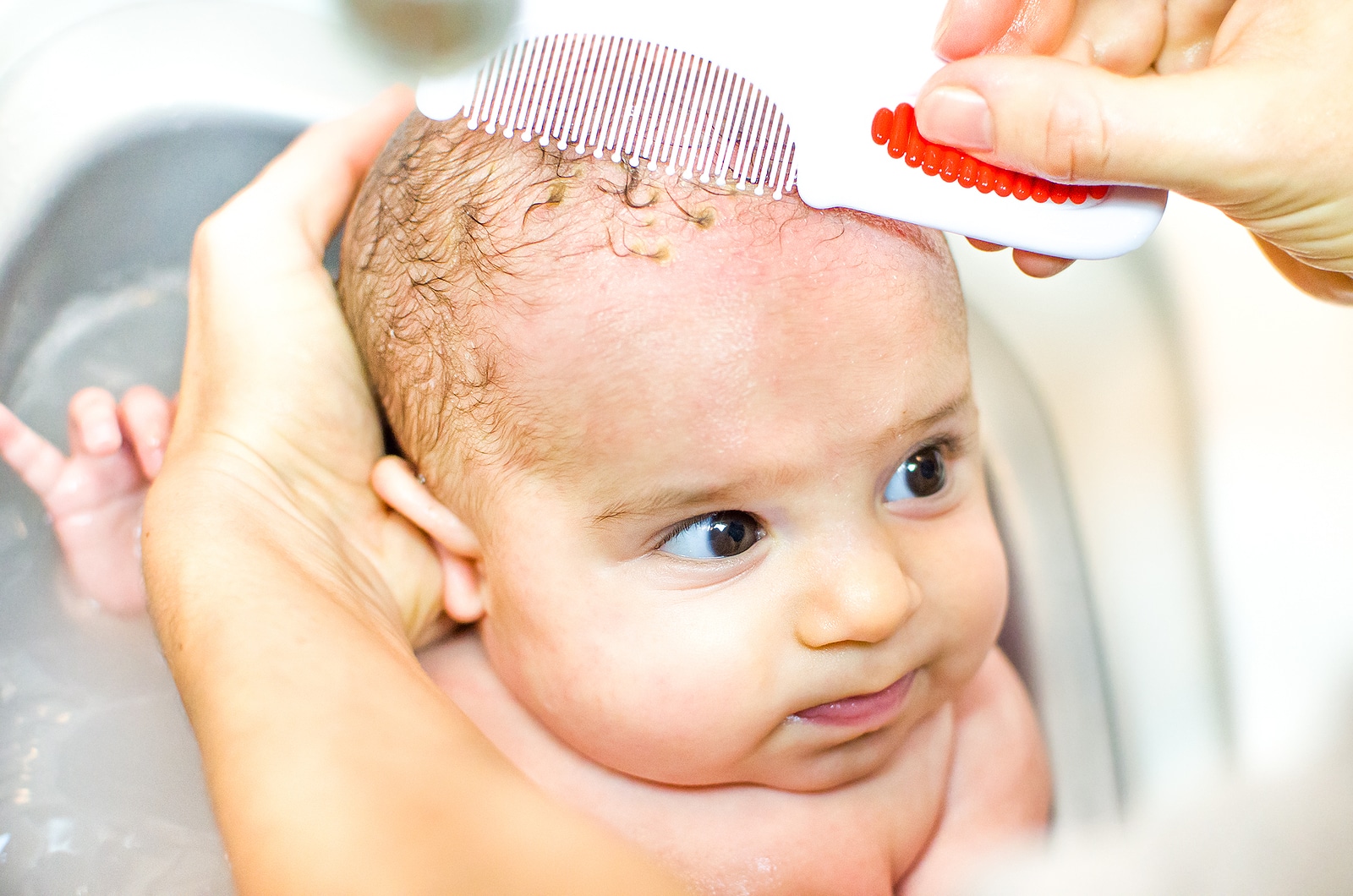 Cradle Cap in Newborns Baby Arabia