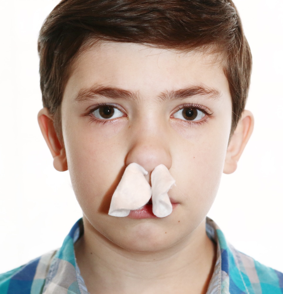 nosebleeds-in-children-when-to-see-a-doctor-causes-and-prevention